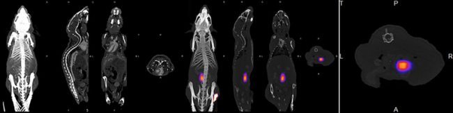 X-Ray CT